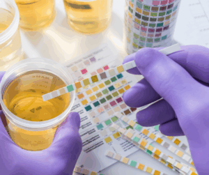 We can do a Toxic Metals and Elements test, which uses your urine and saliva to look for heavy metals.