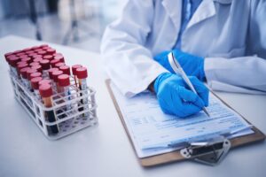 Most people are used to getting blood work done, but for checking hormones, the blood has some limitations. 
