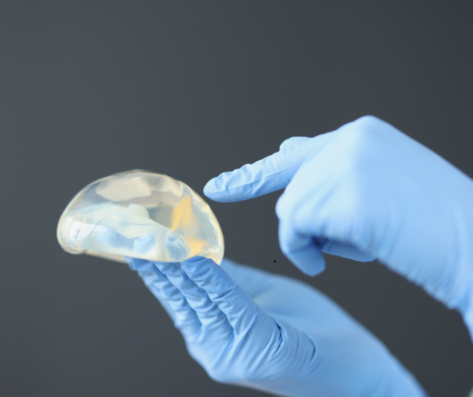 Could your breast implants be growing mold and making you sick?
