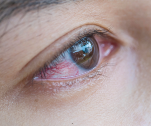Blurry vision, broken capillaries, dry eyes, and blood pressure issues can be signs your hormones are off.