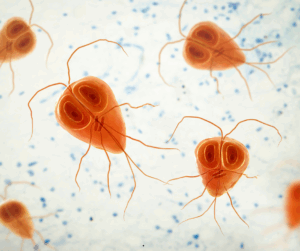 Do I need a Parasite Cleanse? 13 Do some of your own research on parasites, and you'll find some crazy alien-looking things!