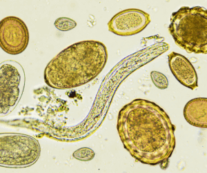Do I need a Parasite Cleanse? 10 Some parasites are only visible under a microscope.