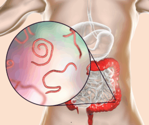 Do I need a Parasite Cleanse? 15 There's no telling how much better you could feel if you eliminate unwanted bugs from your gut!