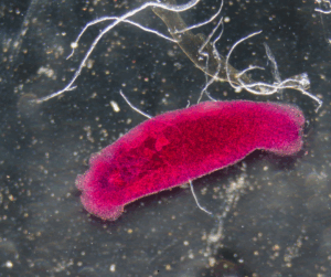 Do I need a Parasite Cleanse? 11 Liver flukes are actually quite large and can be very unusual looking.