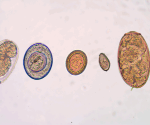 Do I need a Parasite Cleanse? 14 We are here for you, to answer all your questions!