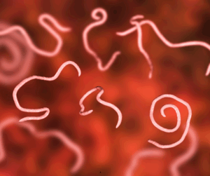 Do I need a Parasite Cleanse? 7 Don't be shocked if you see some unusual things come out during your Cleanse. That's what we're trying to do!