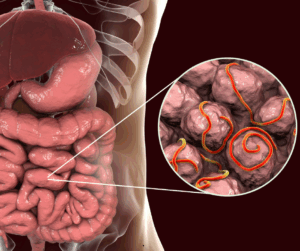 Do I need a Parasite Cleanse? 8 Parasites can be anywhere, in any cavity or tissue of the body.